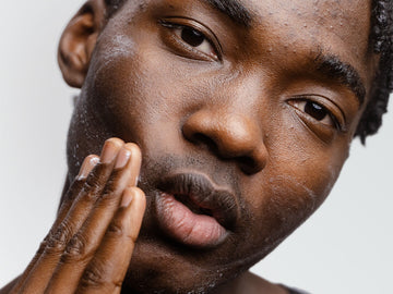 Acne & Blemishes