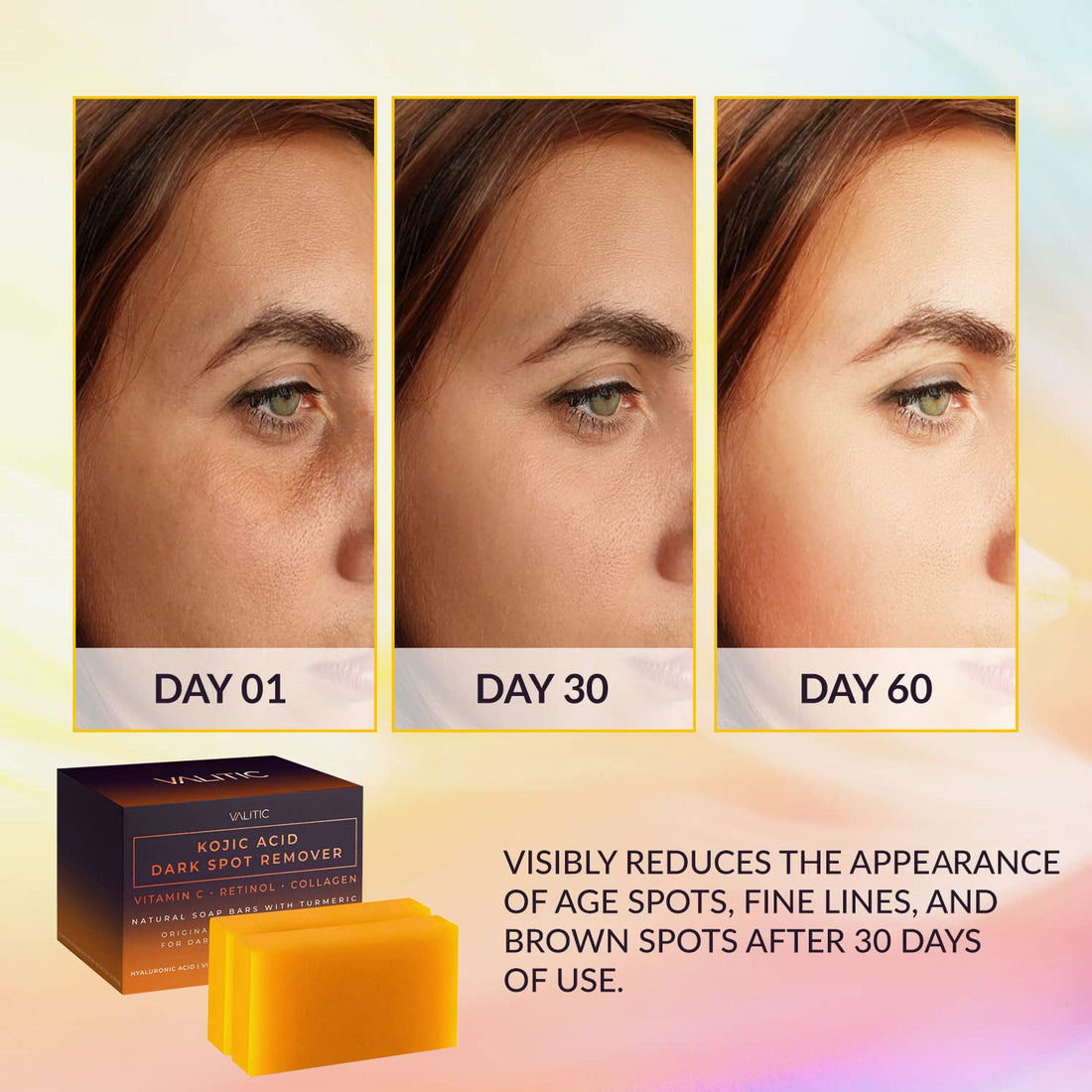 VALITIC, Kojic Acid, Dark Spot Remover Soap Bar, with Vitamin C, Retinol, Collagen, Turmeric, 2 Pack